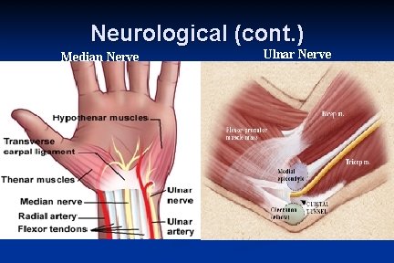 Neurological (cont. ) Median Nerve Ulnar Nerve 