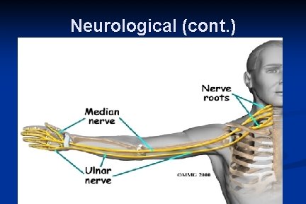 Neurological (cont. ) 