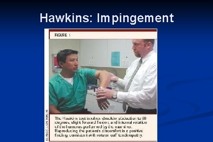 Hawkins: Impingement 