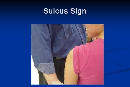 Sulcus Sign 
