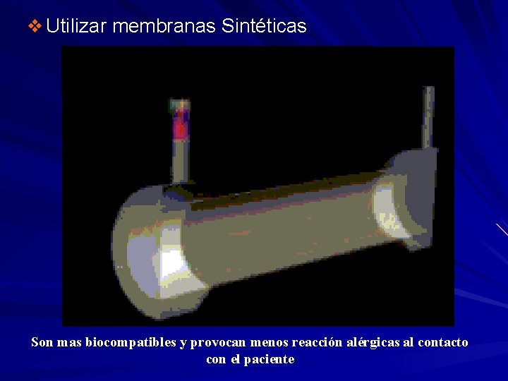 v Utilizar membranas Sintéticas Son mas biocompatibles y provocan menos reacción alérgicas al contacto