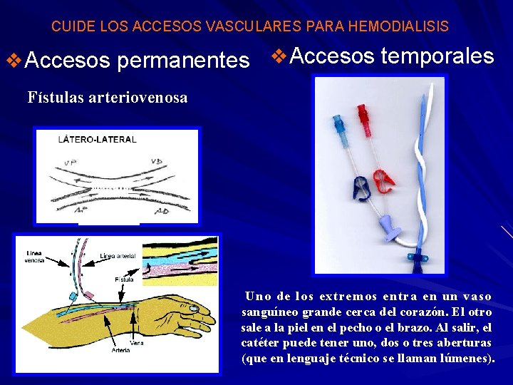 CUIDE LOS ACCESOS VASCULARES PARA HEMODIALISIS v Accesos permanentes v Accesos temporales Fístulas arteriovenosa
