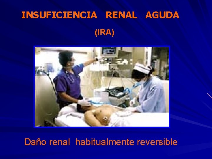 INSUFICIENCIA RENAL AGUDA (IRA) Daño renal habitualmente reversible 