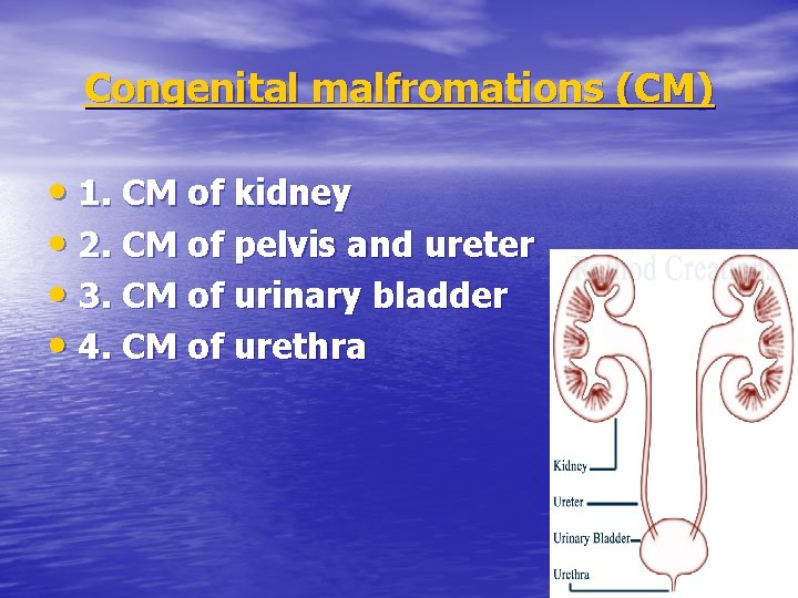 Congenital malfromations (CM) • 1. CM of kidney • 2. CM of pelvis and