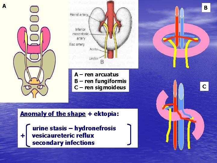 A B A – ren arcuatus B – ren fungiformis C – ren sigmoideus