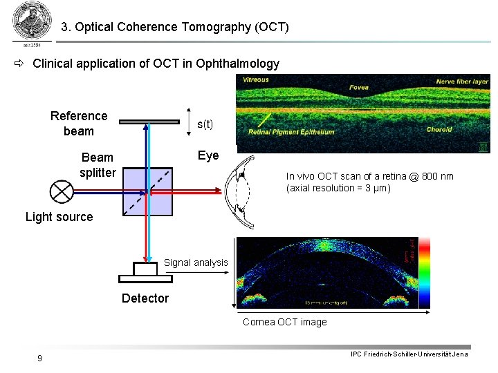 3. Optical Coherence Tomography (OCT) Clinical application of OCT in Ophthalmology Reference beam Eye