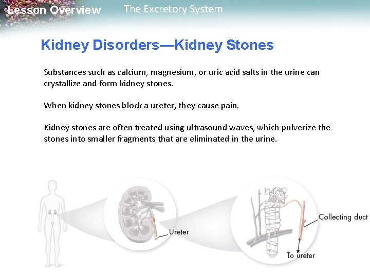 Lesson Overview The Excretory System Kidney Disorders—Kidney Stones Substances such as calcium, magnesium, or