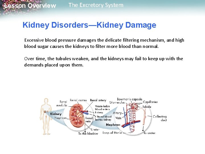 Lesson Overview The Excretory System Kidney Disorders—Kidney Damage Excessive blood pressure damages the delicate