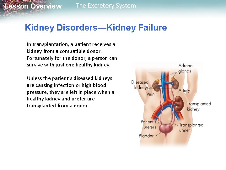 Lesson Overview The Excretory System Kidney Disorders—Kidney Failure In transplantation, a patient receives a