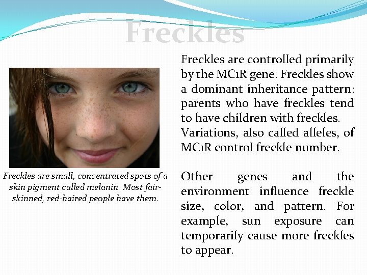 Freckles are controlled primarily by the MC 1 R gene. Freckles show a dominant