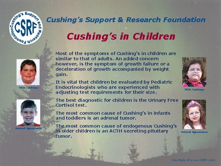 Cushing’s Support & Research Foundation Cushing’s in Children Most of the symptoms of Cushing’s Cushing’s Support & Research Foundation Cushing’s in Children Most of the symptoms of Cushing’s