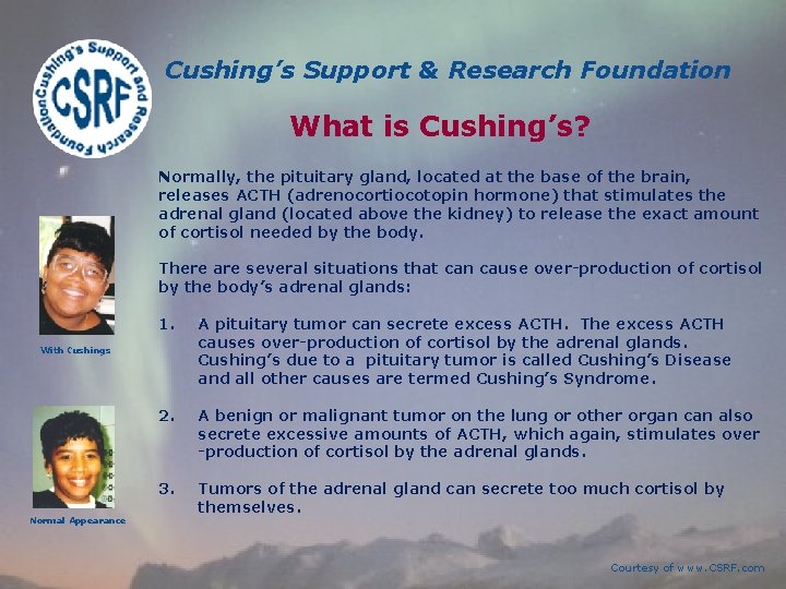 Cushing’s Support & Research Foundation What is Cushing’s? Normally, the pituitary gland, located at Cushing’s Support & Research Foundation What is Cushing’s? Normally, the pituitary gland, located at
