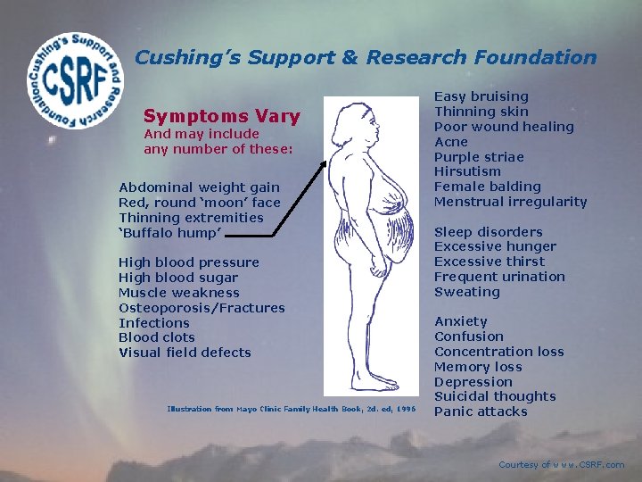 Cushing’s Support & Research Foundation Symptoms Vary And may include any number of these: Cushing’s Support & Research Foundation Symptoms Vary And may include any number of these: