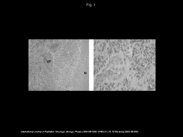 Fig. 1 International Journal of Radiation Oncology, Biology, Physics 2004 581336 -1345 DOI: (10.