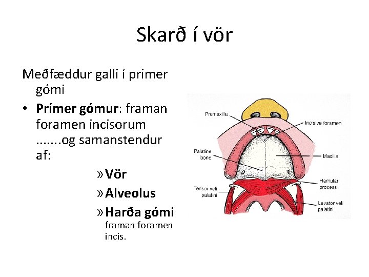 Skarð í vör Meðfæddur galli í primer gómi • Prímer gómur: framan foramen incisorum.