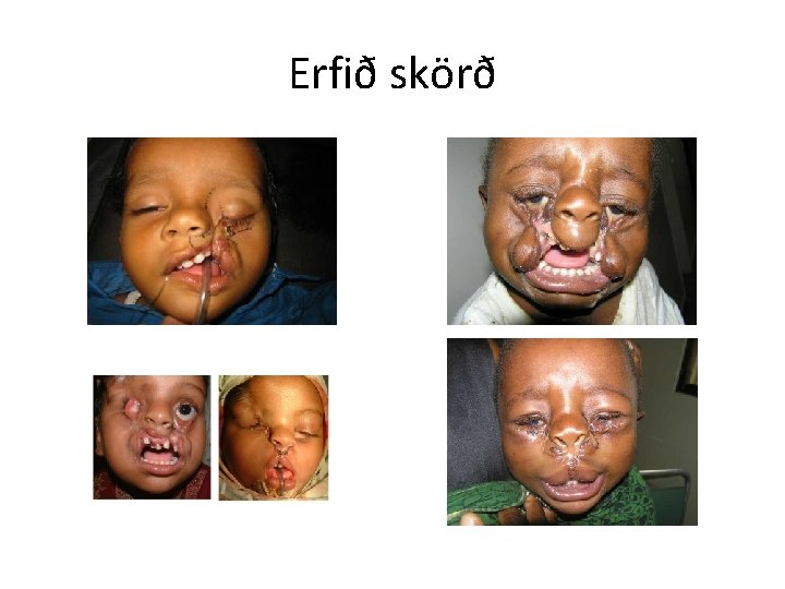 Erfið skörð 