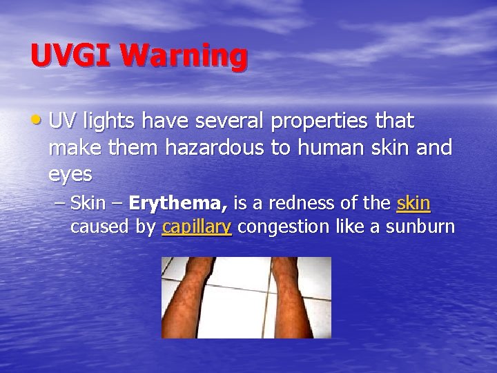 UVGI Warning • UV lights have several properties that make them hazardous to human