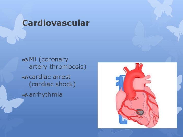 Cardiovascular MI (coronary artery thrombosis) cardiac arrest (cardiac shock) arrhythmia 