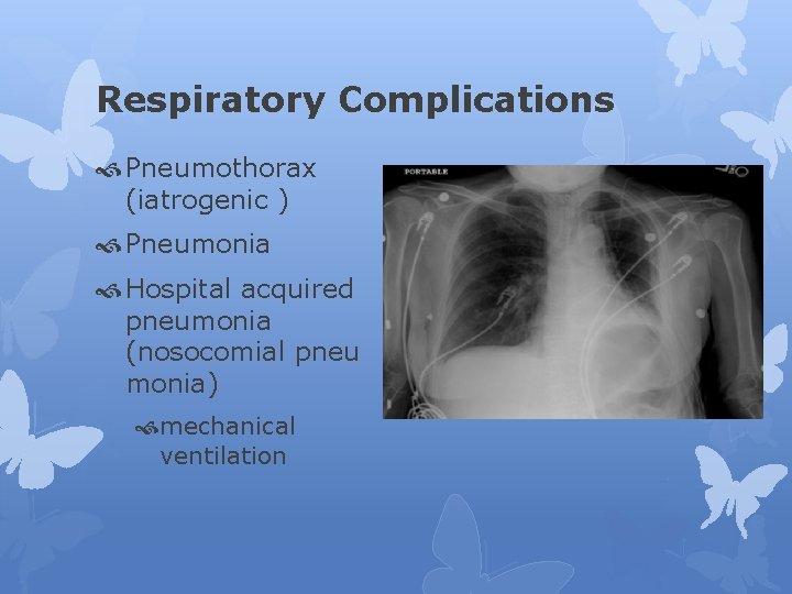 Respiratory Complications Pneumothorax (iatrogenic ) Pneumonia Hospital acquired pneumonia (nosocomial pneu monia) mechanical ventilation