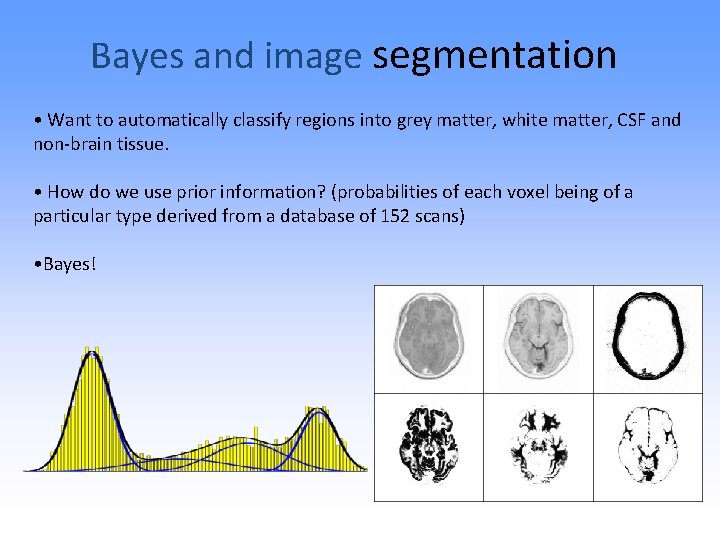 Bayes and image segmentation • Want to automatically classify regions into grey matter, white