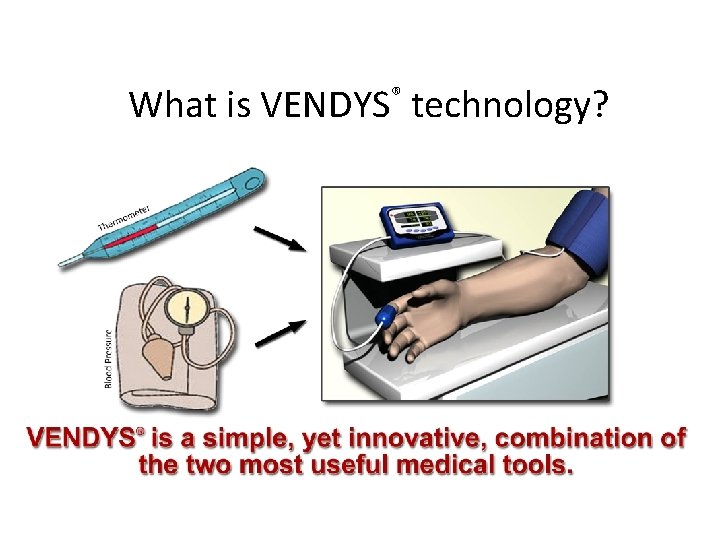 What is VENDYS technology? ® 