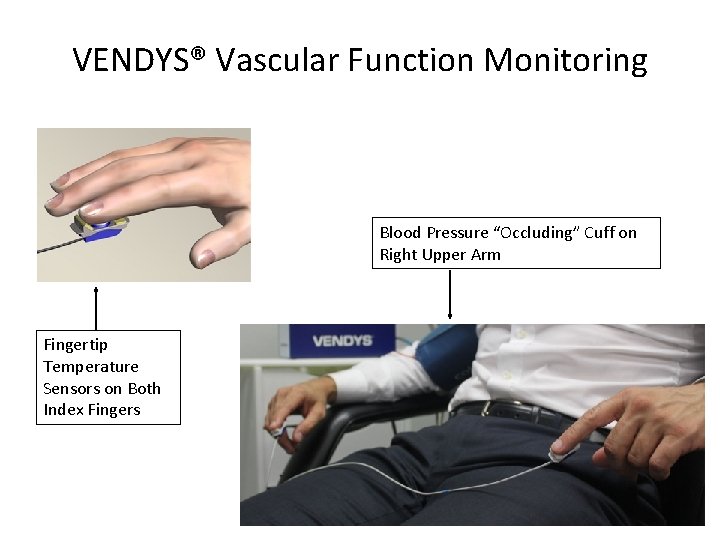 VENDYS® Vascular Function Monitoring Blood Pressure “Occluding” Cuff on Right Upper Arm Fingertip Temperature