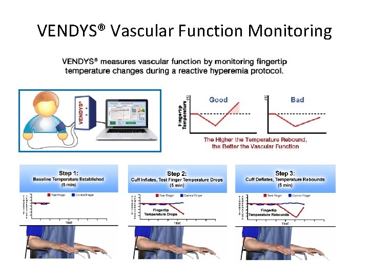 VENDYS® Vascular Function Monitoring 