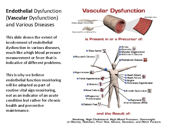 Endothelial Dysfunction (Vascular Dysfunction) and Various Diseases This slide shows the extent of involvement