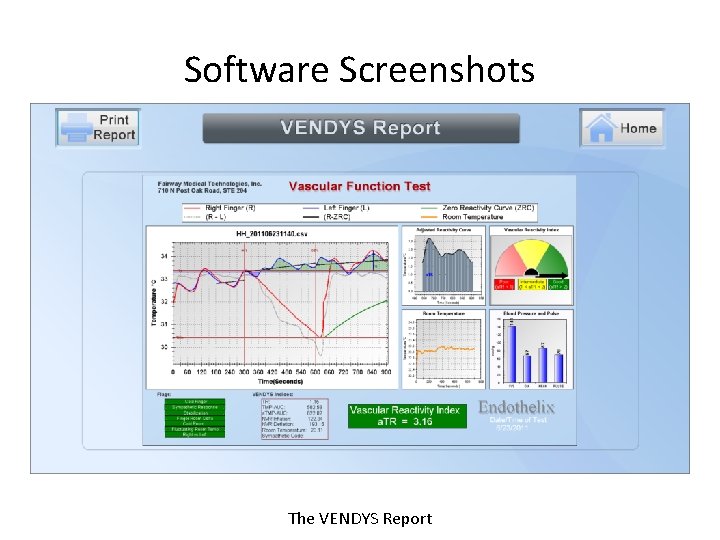 Software Screenshots The VENDYS Report 