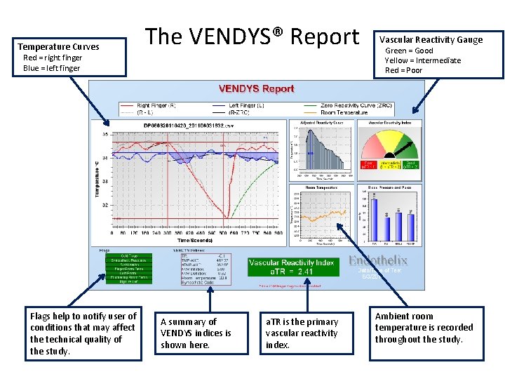 Temperature Curves The VENDYS® Report Red = right finger Blue = left finger Flags