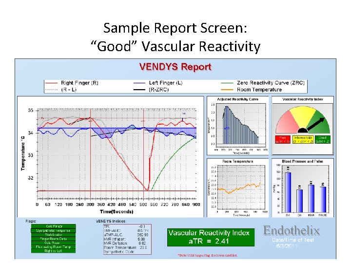 Sample Report Screen: “Good” Vascular Reactivity 