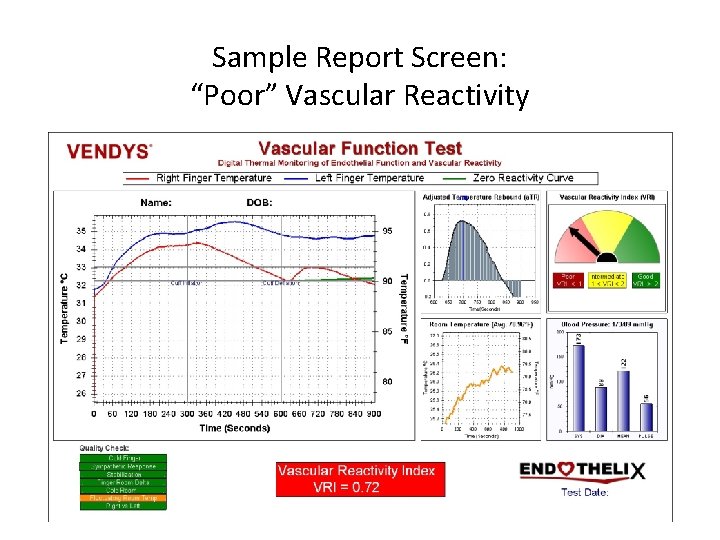 Sample Report Screen: “Poor” Vascular Reactivity 