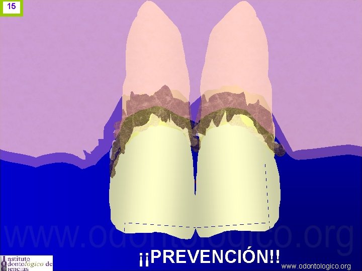 15 ¡¡PREVENCIÓN!! www. odontologico. org 