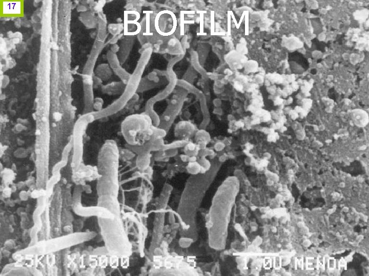 17 BIOFILM www. odontologico. org 