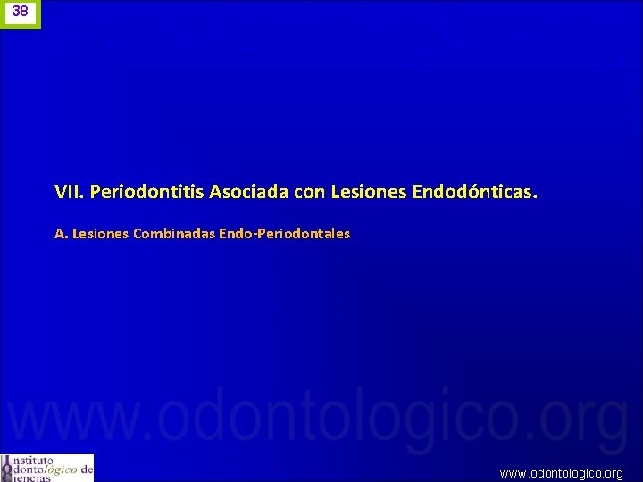 38 VII. Periodontitis Asociada con Lesiones Endodónticas. A. Lesiones Combinadas Endo-Periodontales www. odontologico. org