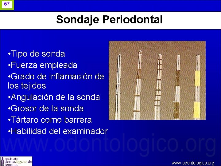 57 Sondaje Periodontal • Tipo de sonda • Fuerza empleada • Grado de inflamación