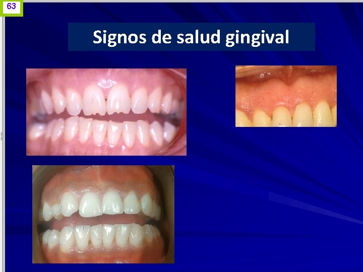 63 Signos de salud gingival www. odontologico. org 