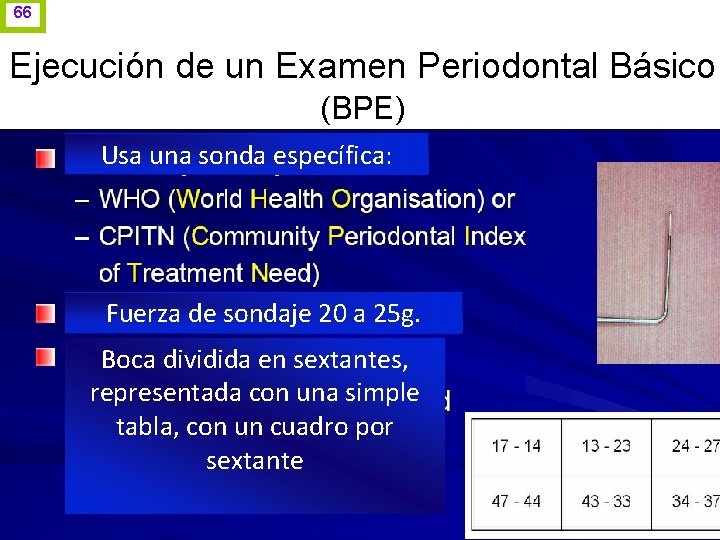 66 Ejecución de un Examen Periodontal Básico (BPE) Usa una sonda específica: Fuerza de