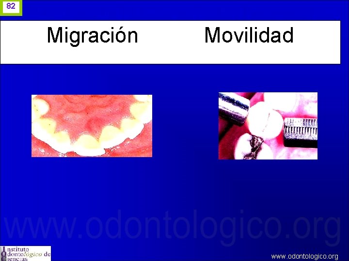 82 Migración Movilidad www. odontologico. org 