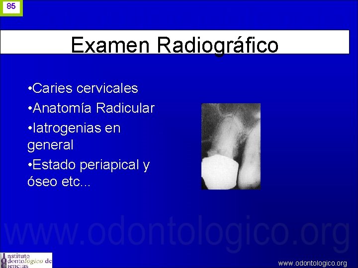 85 Examen Radiográfico • Caries cervicales • Anatomía Radicular • Iatrogenias en general •