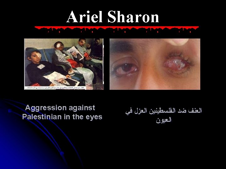 Ariel Sharon Aggression against Palestinian in the eyes ﺍﻟﻌﻨﻒ ﺿﺪ ﺍﻟﻔﻠﺴﻄﻴﻨﻴﻦ ﺍﻟﻌﺰﻝ ﻓﻲ ﺍﻟﻌﻴﻮﻥ