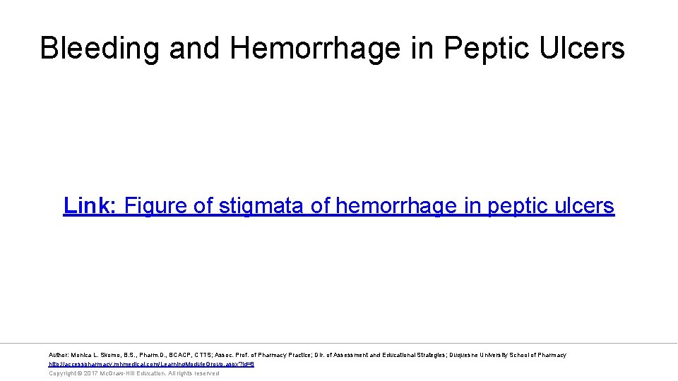 Bleeding and Hemorrhage in Peptic Ulcers Link: Figure of stigmata of hemorrhage in peptic