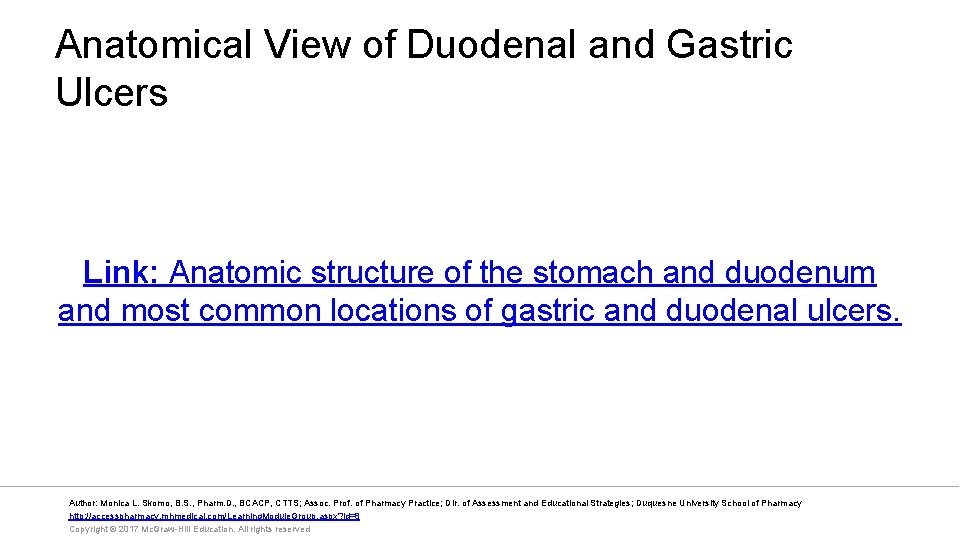 Anatomical View of Duodenal and Gastric Ulcers Link: Anatomic structure of the stomach and