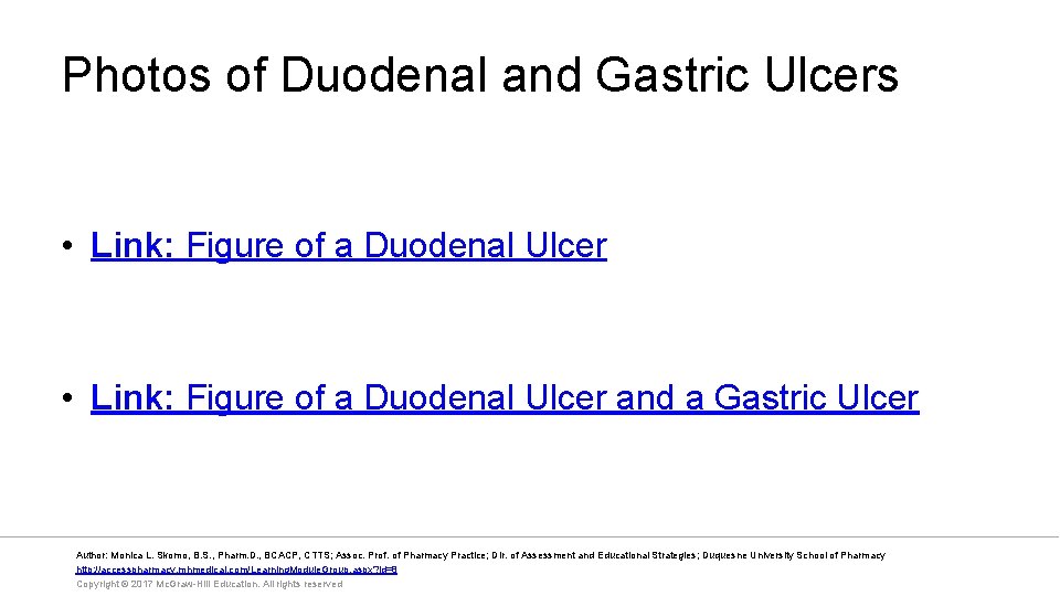 Photos of Duodenal and Gastric Ulcers • Link: Figure of a Duodenal Ulcer and
