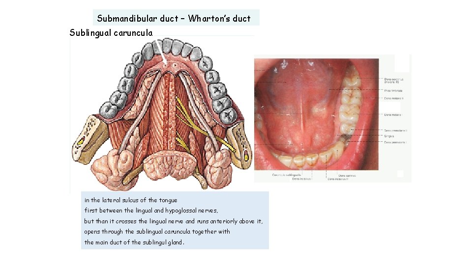 Submandibular duct – Wharton’s duct Sublingual caruncula in the lateral sulcus of the tongue
