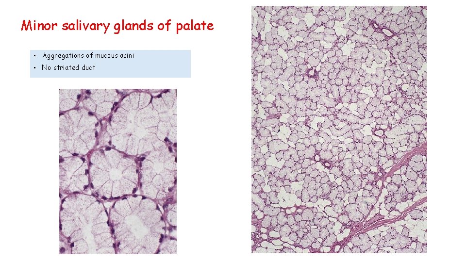 Minor salivary glands of palate • Aggregations of mucous acini • No striated duct
