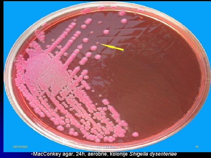 10/31/2020 alen vukelić, dr • Mac. Conkey agar, 24 h, aerobne, kolonije Shigella dysenteriae