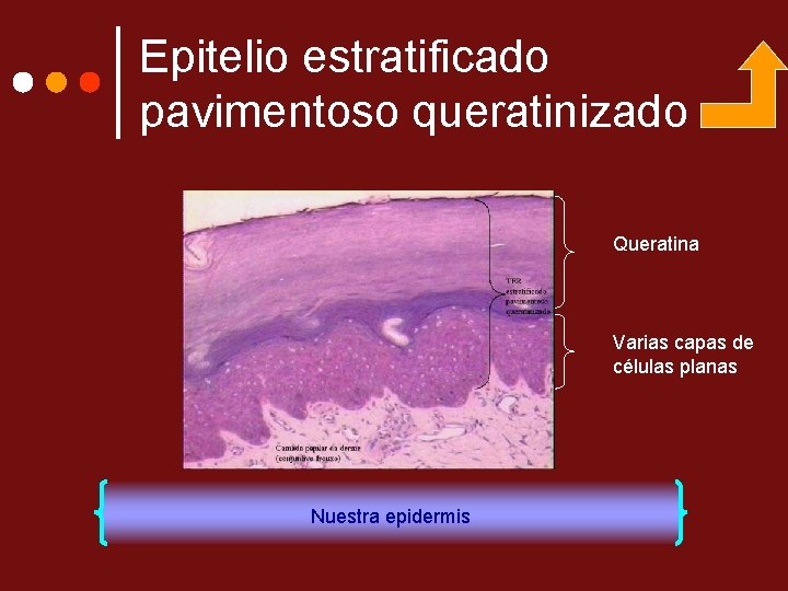 Epitelio estratificado pavimentoso queratinizado Queratina Varias capas de células planas Nuestra epidermis 