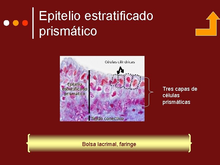 Epitelio estratificado prismático Tres capas de células prismáticas Bolsa lacrimal, faringe 