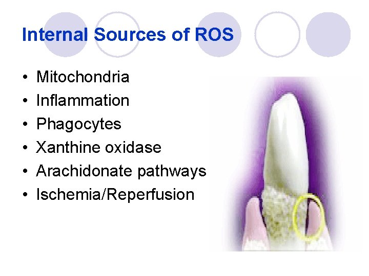 Internal Sources of ROS • • • Mitochondria Inflammation Phagocytes Xanthine oxidase Arachidonate pathways